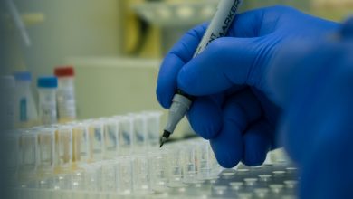 Все государственные и частные лаборатории смогут проводить тесты на коронавирусную инфекцию. Об этом сообщили…