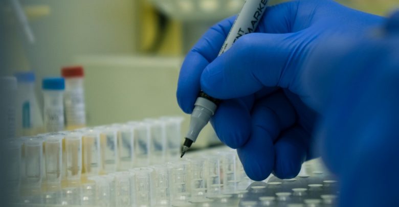 Все государственные и частные лаборатории смогут проводить тесты на коронавирусную инфекцию. Об этом сообщили…
