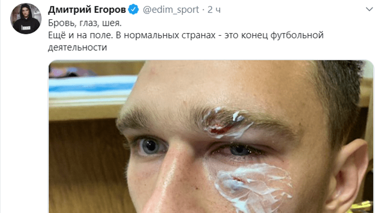 Полиция заинтересовалась сообщением о том, что футболист Широков избил арбитра