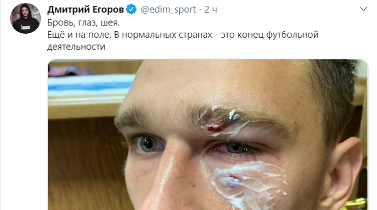 В отношении футболиста Широкова возбудили уголовное дело за избиение арбитра |
