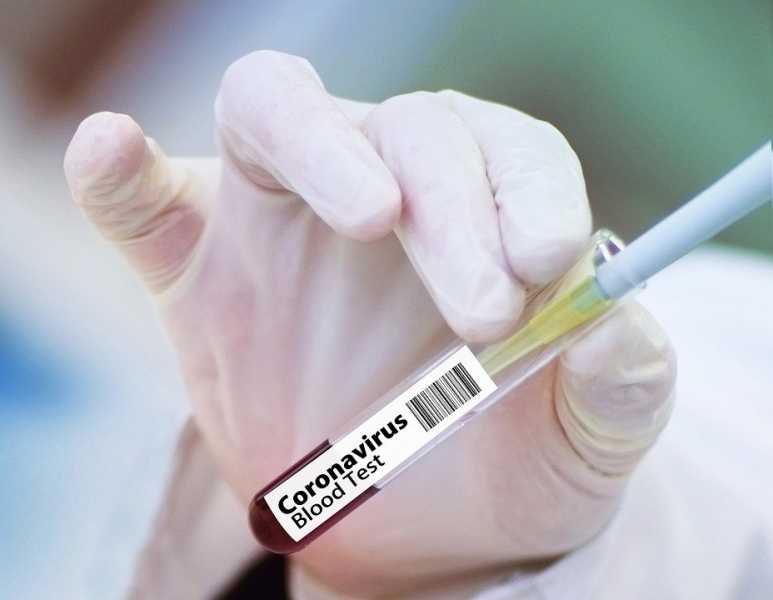 За сутки на коронавирус проверили еще 40 тысяч петербуржцев |