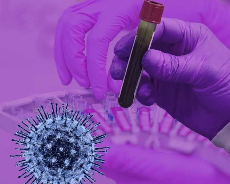 В США проводят расследование из-за смерти американца после прививки от коронавируса