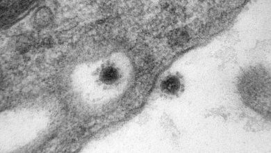 Центр «Вектор» с помощью электронного микроскопа сделал фото дельта-штамма коронавируса