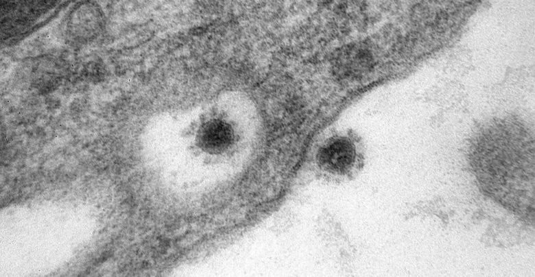Центр «Вектор» с помощью электронного микроскопа сделал фото дельта-штамма коронавируса